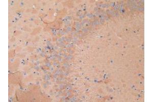 Figure. (Dynamin 1 抗体  (AA 572-745))