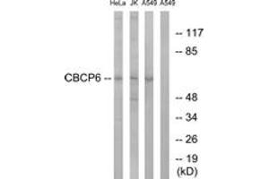 Western blot analysis of extracts from A549/HeLa/Jurkat cells, using AGBL4 Antibody. (AGBL4 抗体  (AA 431-480))