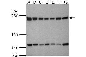 WB Image Sample(30μg whole cell lysate) A: 293T B: A431 , C: H1299 D: HeLa S3 , E: Hep G2 , F: MOLT4 , G: Raji , 5% SDS PAGE antibody diluted at 1:1000 (BTAF1 抗体  (C-Term))