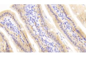 Immunohistochemistry (IHC) image for anti-Retinol Binding Protein 2, Cellular (RBP2) (AA 1-134) antibody (ABIN7429292)