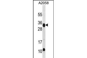 RAET1E Antibody (Center) (ABIN1881724 and ABIN2838636) western blot analysis in  cell line lysates (35 μg/lane). (Retinoic Acid Early Transcript 1E (RAET1E) (AA 150-179) 抗体)
