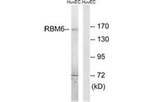 Western blot analysis of extracts from HuvEc cells, using RBM6 Antibody. (RBM6 抗体  (AA 991-1040))