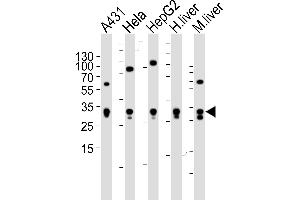 Western blot analysis of lysates from A431, Hela, HepG2 cell line , human liver and mouse liver tissue lysate(from left to right), using ETFA Antibody (Center) (ABIN6243648 and ABIN6577412). (ETFA 抗体  (AA 192-226))