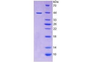 Image no. 1 for Tumor Necrosis Factor Receptor Superfamily, Member 12A (TNFRSF12A) (AA 24-126) (Active) protein (His tag,GST tag) (ABIN6239776) (TNFRSF12A Protein (AA 24-126) (His tag,GST tag))