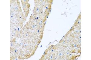 Immunohistochemistry of paraffin-embedded Mouse heart using COX6B1 Polyclonal Antibody at dilution of 1:100 (40x lens). (COX6B1 抗体)