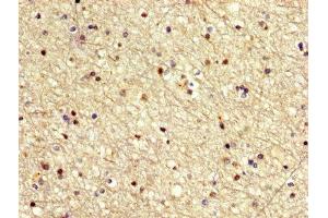 IHC image of ABIN7155497 diluted at 1:500 and staining in paraffin-embedded human brain tissue performed on a Leica BondTM system.