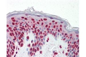 Anti-GSC / Goosecoid antibody IHC staining of human skin. (GSC 抗体  (AA 78-186))