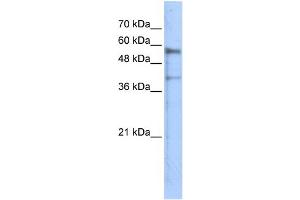 WB Suggested Anti-KREMEN1 Antibody Titration: 0. (KREMEN1 抗体  (N-Term))