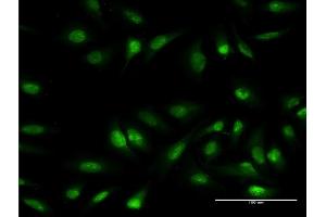 Immunofluorescence of monoclonal antibody to OLIG1 on HeLa cell. (OLIG1 抗体  (AA 80-159))