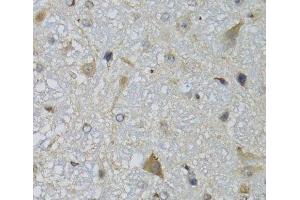 Immunohistochemistry of paraffin-embedded Mouse brain using CHN1 Polyclonal Antibody at dilution of 1:100 (40x lens). (CHN1 抗体)