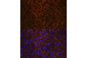 Immunofluorescence analysis of rat brain using Phospho-Tau-T231 antibody (ABIN7268531). (MAPT 抗体  (pThr231))