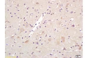 Formalin-fixed and paraffin embedded rat brain labeled with Rabbit Anti Centaurin alpha 1 Polyclonal Antibody, Unconjugated (ABIN1386169) at 1:200 followed by conjugation to the secondary antibody and DAB staining (ADAP1 抗体  (AA 101-200))