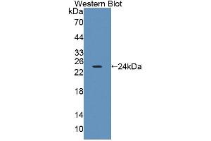 Western Blotting (WB) image for anti-Protein tyrosine Phosphatase, Receptor Type, A (PTPRA) (AA 624-800) antibody (ABIN5014196)