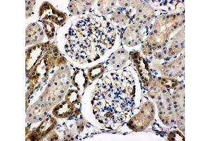IHC-P testing of rat kidney tissue (WISP1 抗体  (C-Term))