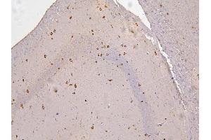 IHC analysis of RBMS3 using anti-RBMS3 antibody (ABIN6719584).