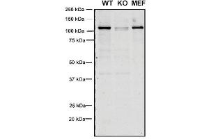Western Blotting (WB) image for anti-Vacuolar Protein Sorting 35 (VPS35) antibody (FITC) (ABIN6932974)