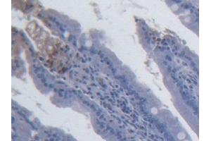 DAB staining on IHC-P; Samples: Rat Small intestine Tissue (IL-15 抗体  (AA 49-162))