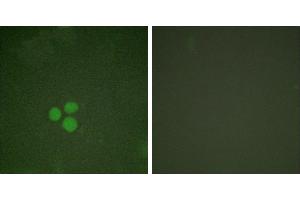 Forskolin + -Immunofluorescence analysis of HeLa cells, treated with Forskolin (40nM, 30mins), using DP-1 antibody. (TGM4 抗体)