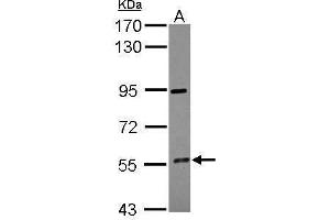 Western Blotting (WB) image for anti-Cytochrome P450, Family 4, Subfamily F, Polypeptide 12 (CYP4F12) (Center) antibody (ABIN2856001)