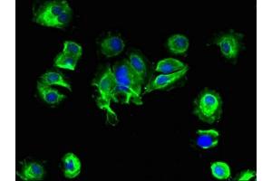 Immunofluorescent analysis of MCF-7 cells using ABIN7145717 at dilution of 1:100 and Alexa Fluor 488-congugated AffiniPure Goat Anti-Rabbit IgG(H+L) (SLC25A14 抗体  (AA 55-111))