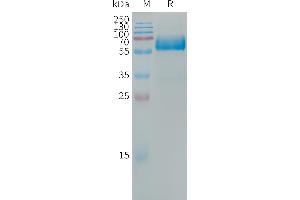 SDS-PAGE (SDS) image for Oxidized Low Density Lipoprotein (Lectin-Like) Receptor 1 (OLR1) protein (Fc Tag) (ABIN7538464)