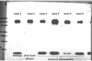 Western Blotting (WB) image for anti-delta Hemolysin antibody (ABIN2998410) (delta Hemolysin 抗体)
