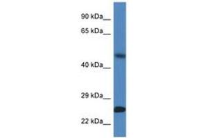 Image no. 1 for anti-Sorting Nexin 10 (SNX10) (AA 100-149) antibody (ABIN6747387) (SNX10 抗体  (AA 100-149))