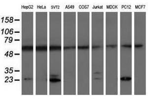 Image no. 2 for anti-Proteasome (Prosome, Macropain) Subunit, beta Type, 9 (Large Multifunctional Peptidase 2) (PSMB9) (AA 21-219) antibody (ABIN1491192) (PSMB9 抗体  (AA 21-219))