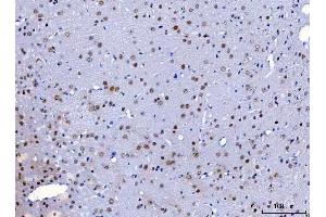 IHC analysis of HnRNP H/HNRNPH1 using anti-HnRNP H/HNRNPH1 antibody (ABIN4886623). (HNRNPH1 抗体  (N-Term))
