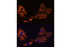 Immunofluorescence analysis of C6 cells using SM antibody (ABIN7270612) at dilution of 1:100. (SMAP1 抗体  (AA 180-250))