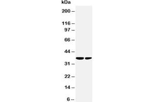 Western blot testing of PP2Ac antibody and Lane 1:  rat kidney (Microtubule Star 抗体  (N-Term))