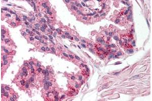 Immunohistochemistry (Paraffin-embedded Sections) (IHC (p)) image for anti-Prostaglandin I2 (Prostacyclin) Synthase (PTGIS) (AA 299-329) antibody (ABIN2451653)