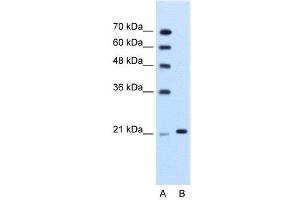 WB Suggested Anti-TRIM26  Antibody Titration: 1. (TRIM26 抗体  (N-Term))