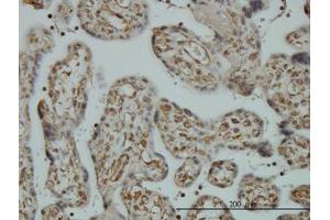 Image no. 1 for anti-Non-SMC Condensin I Complex, Subunit D2 (NCAPD2) (AA 1240-1339) antibody (ABIN599100) (NCAPD2 抗体  (AA 1240-1339))