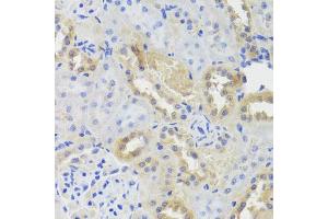 Immunohistochemistry of paraffin-embedded rat kidney using CTSC antibody (ABIN5974676) at dilution of 1/100 (40x lens). (CTSC 抗体)