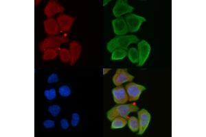 ABIN6262142 and ABIN6272316 staining Hela cells(30 min of UV treatment) by IF/ICC.