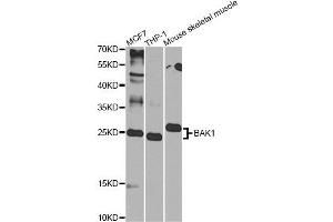 Western blot analysis of extracts of various cell lines, using BAK1 Antibody (ABIN6291814) at 1:1000 dilution. (BAK1 抗体)