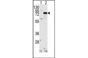 Western blot analysis of PRKCB (arrow) using PKC beta1/2 Antibody (PKC beta 抗体  (C-Term))