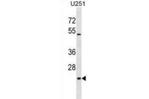 Western Blotting (WB) image for anti-UL16 Binding Protein 2 (ULBP2) antibody (ABIN2999200)