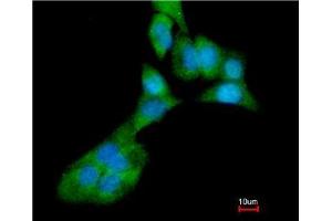 Immunofluorescence analysis of paraformaldehyde-fixed A549, merged with DNA probe using MMP3 antibody at 1:200 dilution.