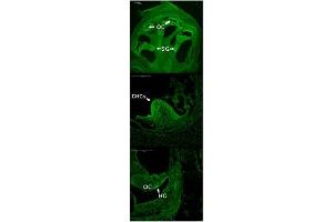 Immunohistochemistry (IHC) image for anti-Atonal Homolog 1 (Drosophila) (ATOH1) (Middle Region) antibody (ABIN2779592)
