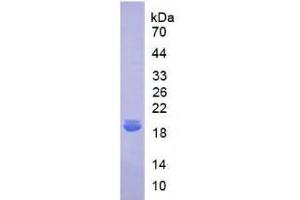 SDS-PAGE analysis of Human IL18BP Protein. (IL18BP 蛋白)