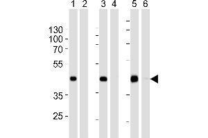 Western blot analysis of extracts from 293 (lanes 1 and 2),HepG2 (lanes 3 and 4)cell line and mouse spleen (lanes 5 and 6)tissue lysate: 1, 3, 5. (STEAP2 抗体  (AA 229-258))
