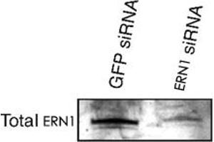 Western blot analysis of ERN1 alpha in transfected min6 cells using ERN1 polyclonal antibody . (ERN1 抗体  (AA 700-800))