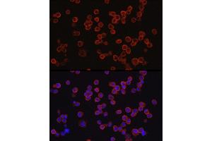 Immunofluorescence analysis of R.