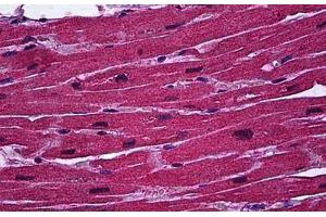 Human Heart: Formalin-Fixed, Paraffin-Embedded (FFPE) (BCL11A 抗体  (AA 1-89))
