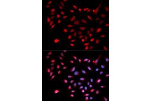 Immunofluorescence analysis of U2OS cell using CDK9 antibody. (CDK9 抗体  (AA 153-372))