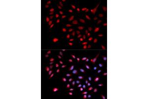 Immunofluorescence analysis of U2OS cell using CDK9 antibody. (CDK9 抗体  (AA 153-372))
