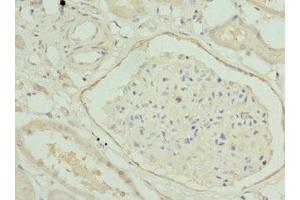 Immunohistochemistry of paraffin-embedded human kidney tissue using ABIN7155892 at dilution of 1:100 (HGD 抗体  (AA 226-445))