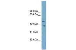 Image no. 1 for anti-Sparc/osteonectin, Cwcv and Kazal-Like Domains Proteoglycan (Testican) 3 (SPOCK3) (AA 359-408) antibody (ABIN6743341) (SPOCK3 抗体  (AA 359-408))